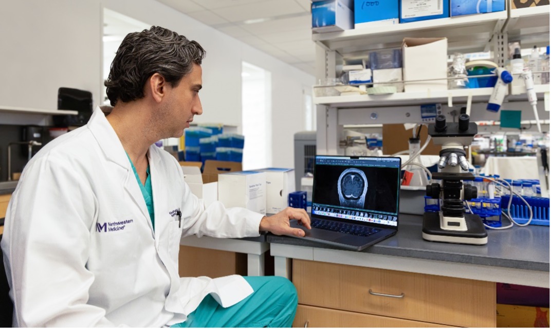 Doctor looking at a laptop with an image of a brain with a glioblastoma