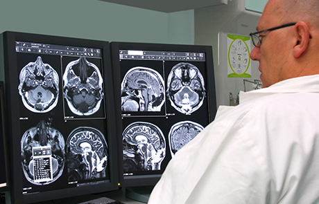 Doctor examining brain scans 