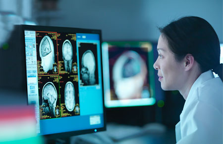 A movement disorders physician reviewing a brain scan on a computer.