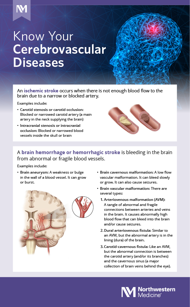 Know Your Cerebrovascular Diseases