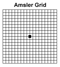 Amsler Grid: A Quick Test For Macular Degeneration and Other Vision  Problems — Sunshine Optometry