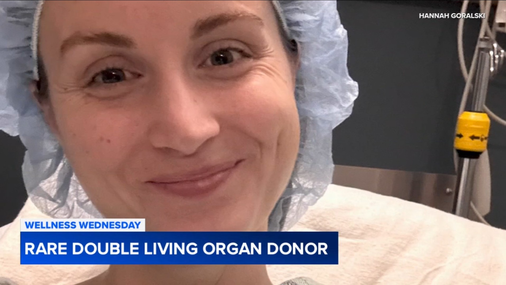 Rare double living organ donor