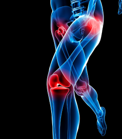 A blue illustration for a person experiencing joint pain in their knees and hips.