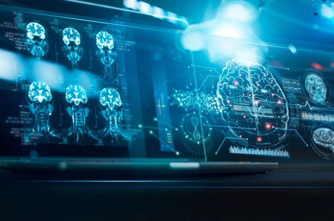 Stroke related medical imaging