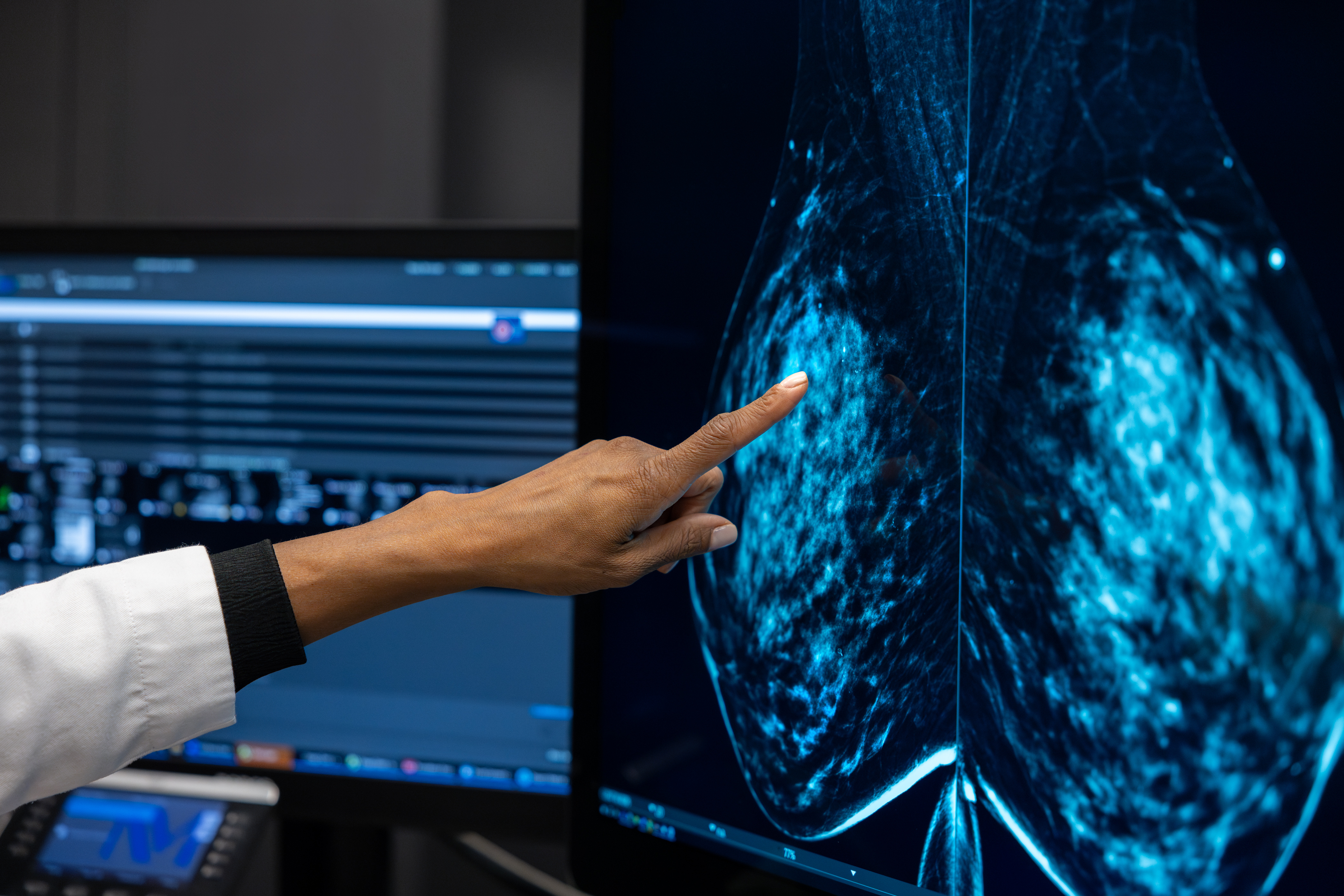 hand pointing at mammography images