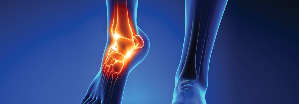 Image of bones in foot and ankle