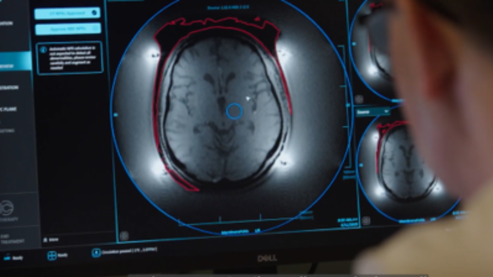Person looking at a computer screen showing an image of a brain.