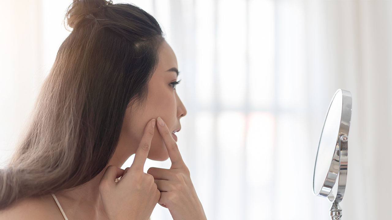 Breakouts From Face Masks | Northwestern Medicine