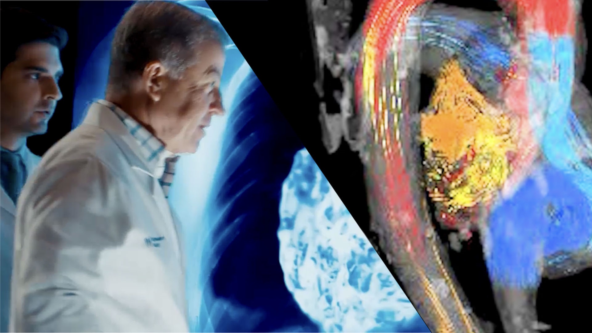健康・医学 mi Heart & Vascular Care | Northwestern Medicine