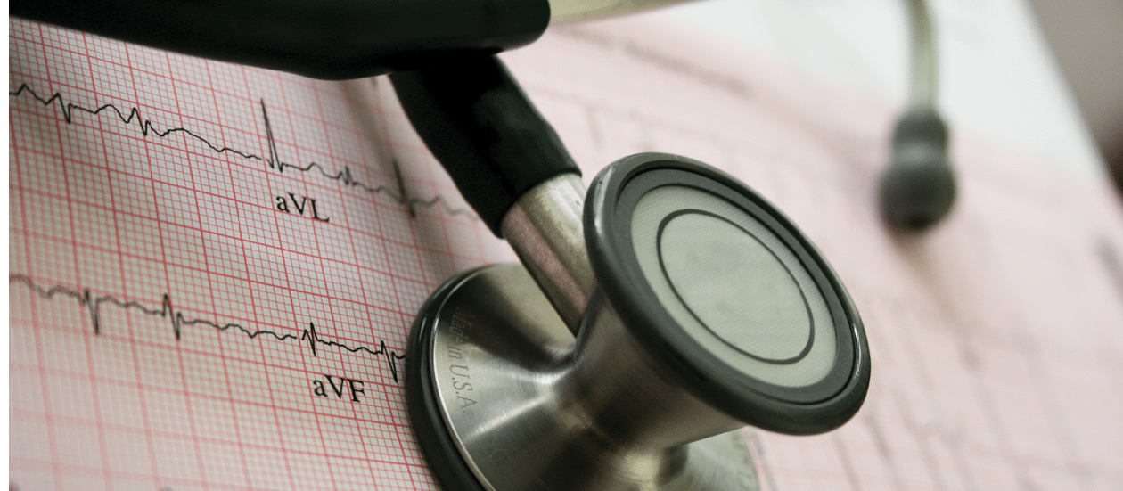 Stethoscope and EKG (ECG) strip. EKG strip shows atrial fibrillation