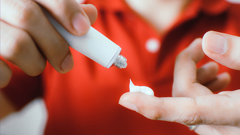 A closeup of a person putting medical ointment from a tube on their index finger.
