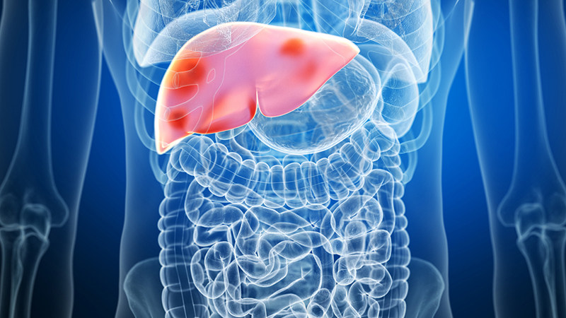 Computer illustration of a solid red liver inside a blue outline rendering of a person's abdomen.