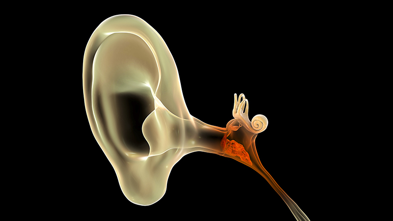 Illustration of an ear infection.