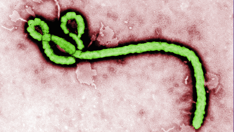 Close-up of an electron microscope image of the Ebola virus, showing long, thread-like particles.