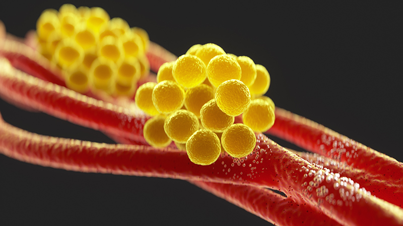 Closeup of Staphylococcus Aureus bacteria inside the human body on a black background.